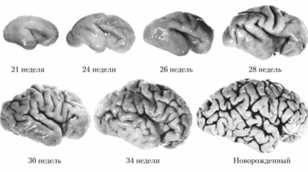 Этапы развития коры головного мозга. Развитие коры больших полушарий головного мозга. Этапы развития коры больших полушарий головного мозга в онтогенезе..