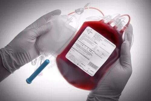 Донорство иркутск. Система для переливания крови. Переливание крови и ее компонентов.