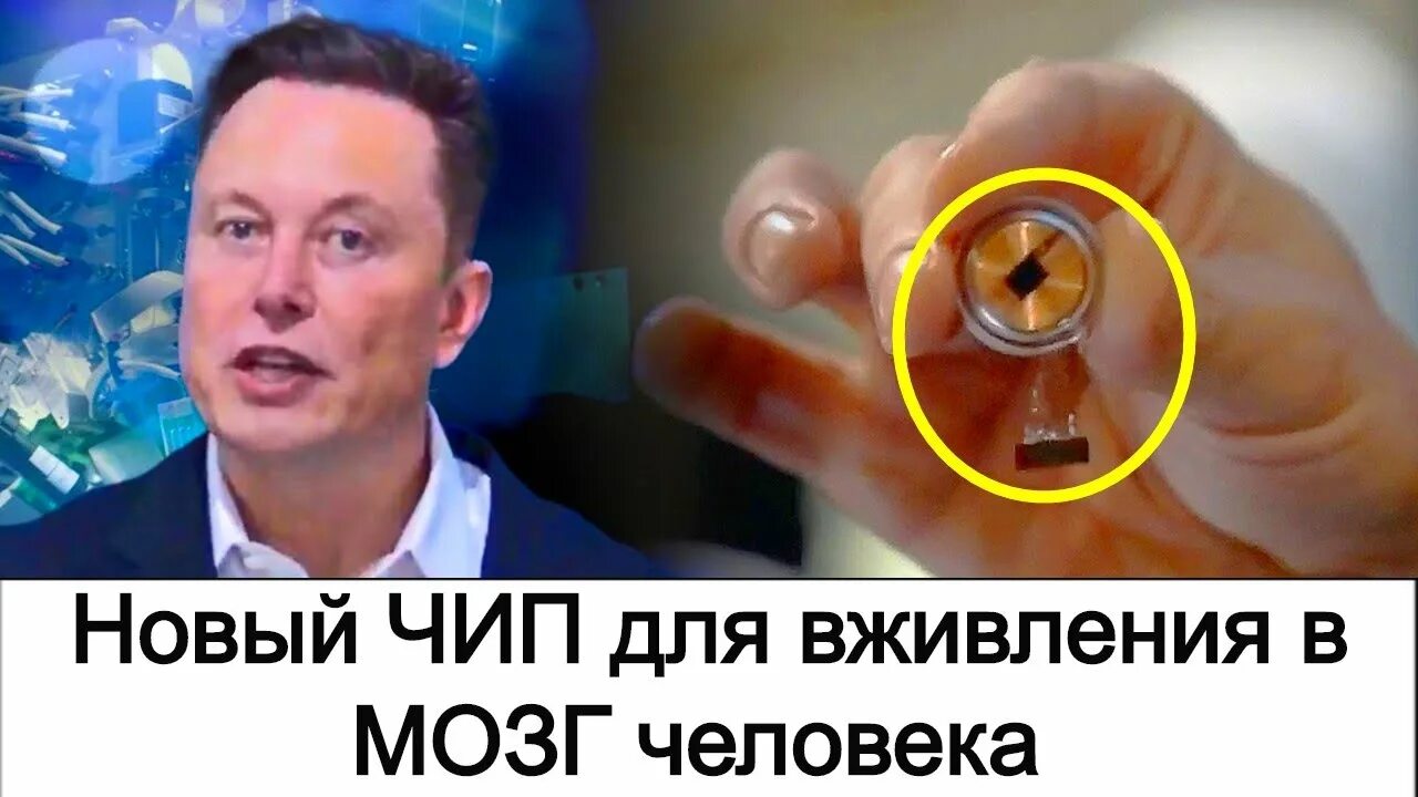 Чип в человека илон маск. Илон Маск чип в мозг. Neuralink чипы в мозг.