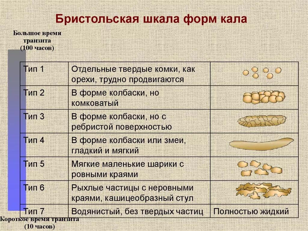 Шкала кала по бристольской шкале. Бристольская шкала кала 6 Тип. Бристольская шкала кала формы кала. Шкала формы стула Бристоля. Бристольская шкала кала норма.