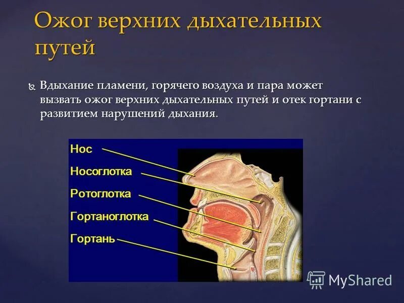 Ожог верхних дыхательных путей соответствует. Степени ожога дыхательных путей. Ожог дыхательных путей процент. Ожог верхних дыхательных путей площадь. Термический ожог дыхательных путей.