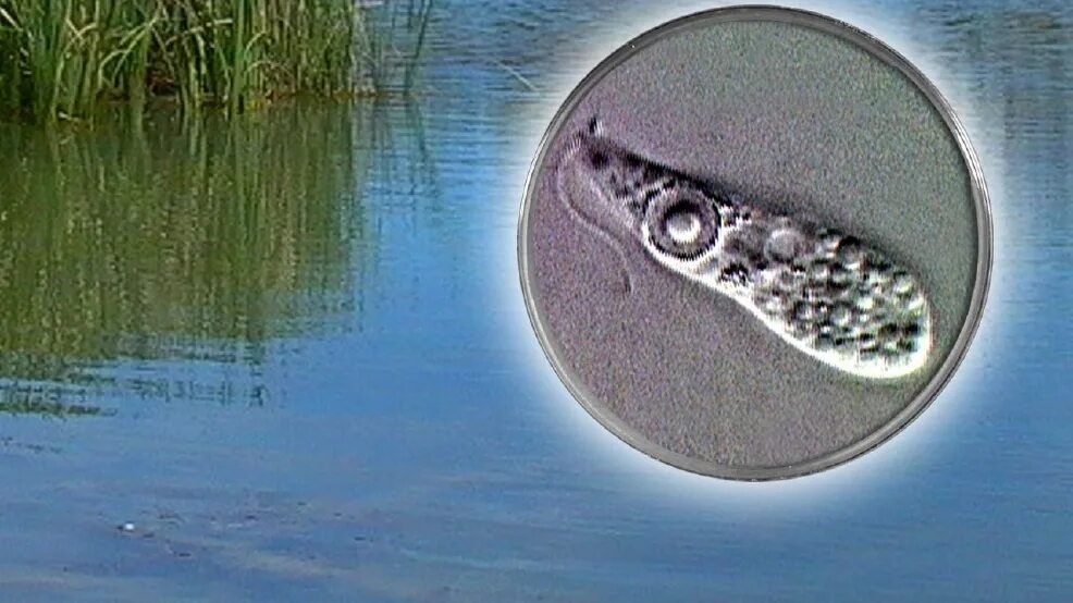 Амебы в водоеме. Амебы в водоеме. Амебы в водоеме. Amoeba sp микроскоп. Амебы в водоеме.