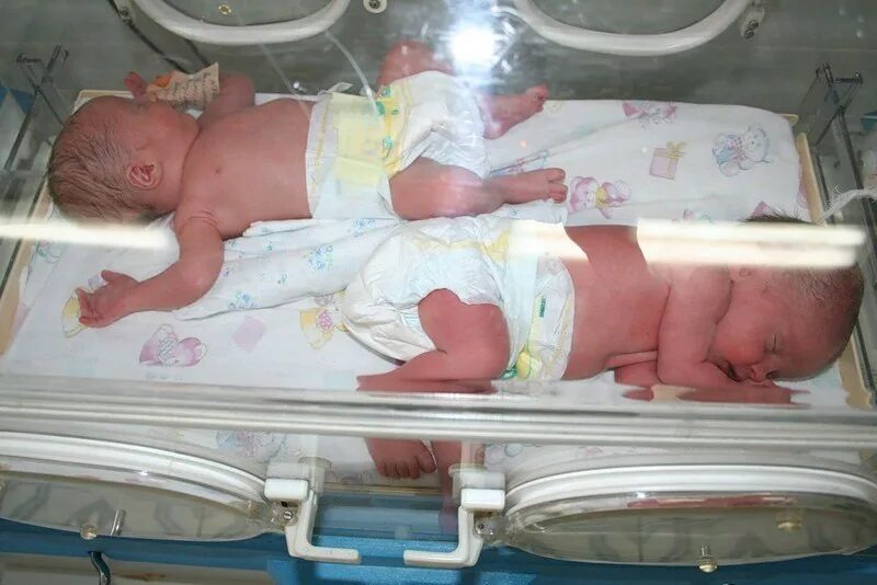 33 неделя двойня. Недоношенные двойняшки. Новорожденный ребенок в роддоме двойня. Новорожденный малыш в роддоме.
