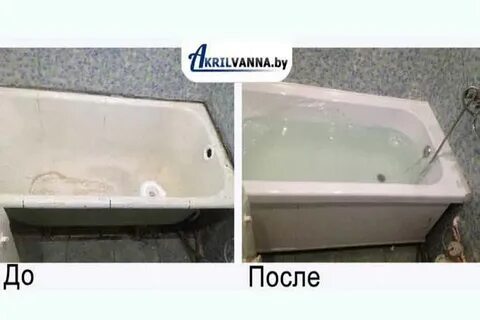 Акриловый вкладыш установить
