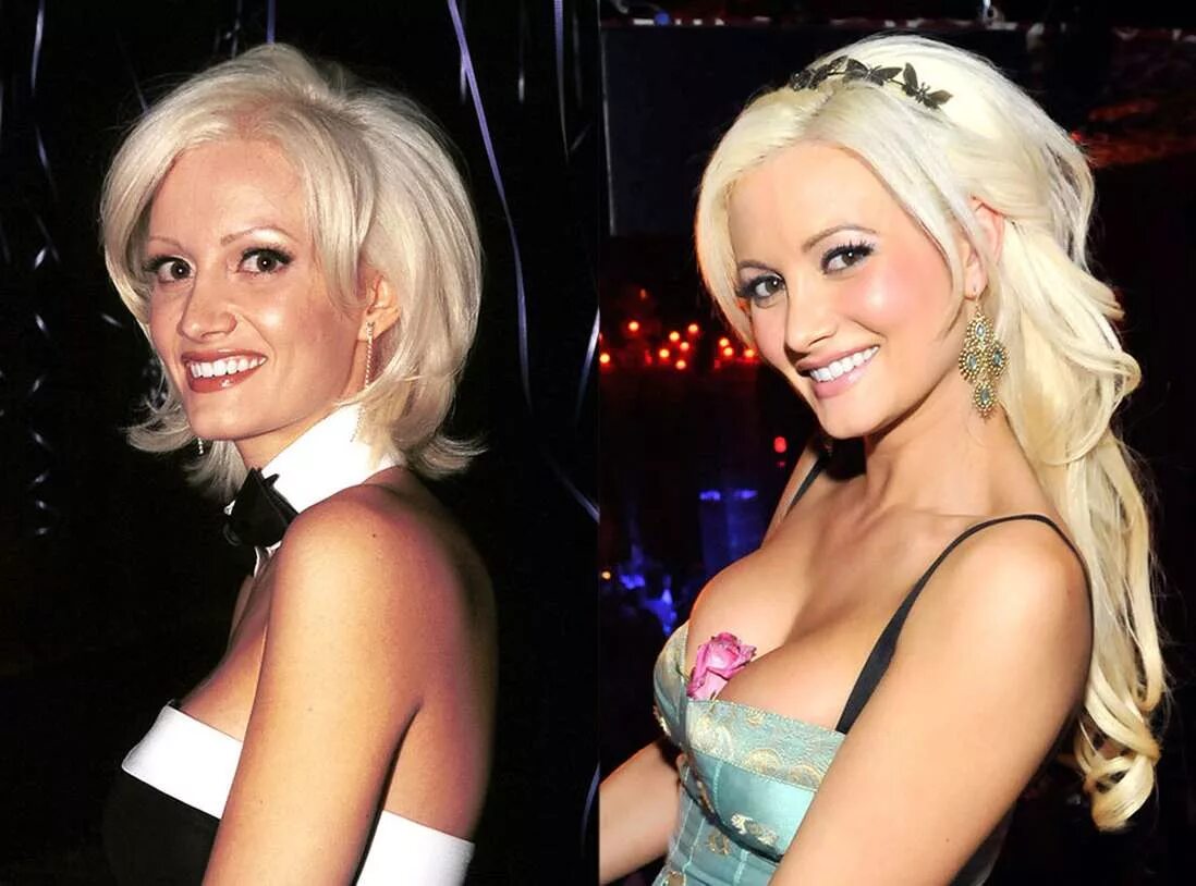 Самбука до пластики. Холли мэдисон до пластики. holly madison до операции. холли мэдисон до и после пластики. холли мэдисон американская модель.