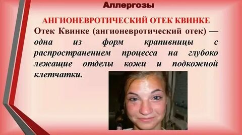 Что значит отекают