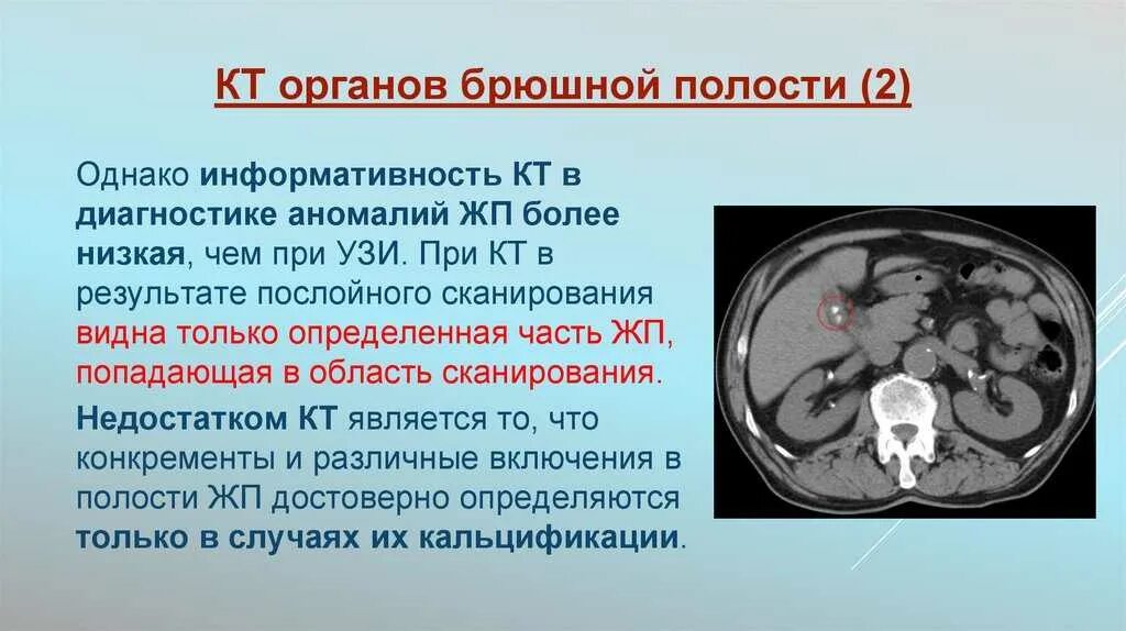 Перед кт что нужно. Кт брюшной полости. Компьютерная томография брюшной. Кт органов брюшной полости. Подготовка к кт брюшной полости.