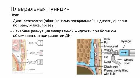 Полость лекарственный