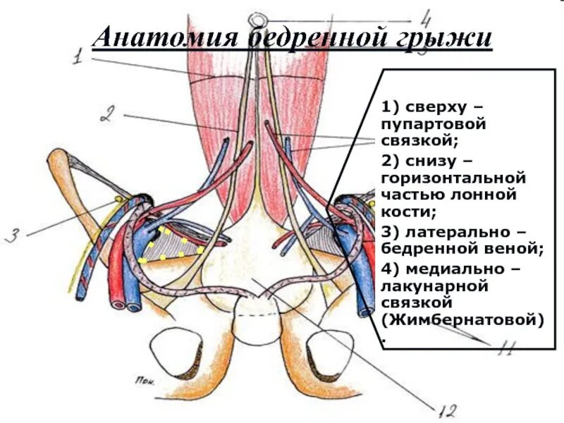 Пупартовой связки