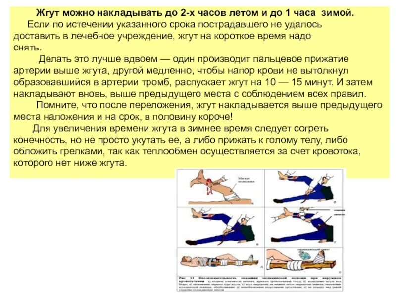 Максимальное наложение жгута зимой. Срок наложения жгута летом. Максимальный срок наложения жгута. Наложение кровоостанавливающего жгута летом и зимой. Жгут зимнее и летнее время