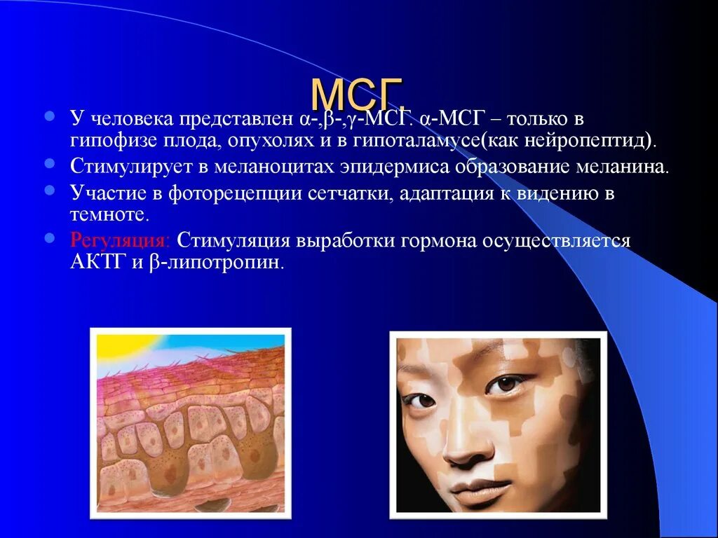 Мсг гормон. Меланоцитстимулирующий гормон патология. меланотропный гормон недостаток. меланоцитстимулирующий гормон гиперфункция. избыток меланоцитостимулирующего гормона.