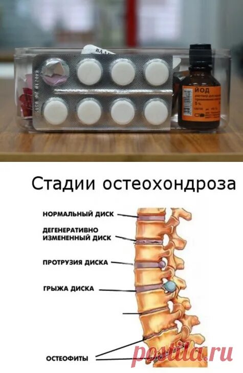 Как снять приступ невралгии в домашних условиях ✅ Межреберная невралгия. Как снять боль тейпированием YouTube