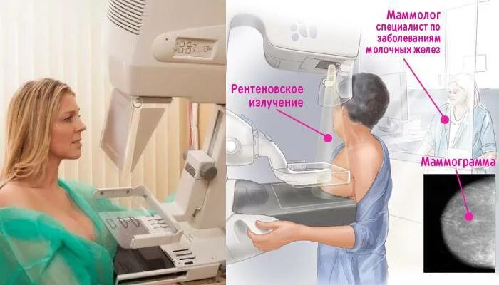 Маммография молочных желез со скольки лет делают. Маммография молочных желез. узи груди. как делают маммографию фото.