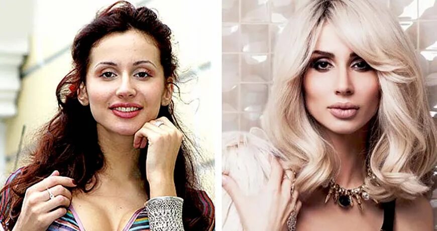Где лобода сейчас находится и чем занимается. Светлана лобода до. светлана лобода до пластики. лобода в молодости. лобода в молодости и сейчас.