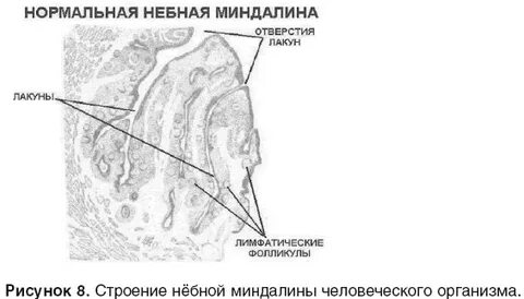 Исследование небных миндалин спб