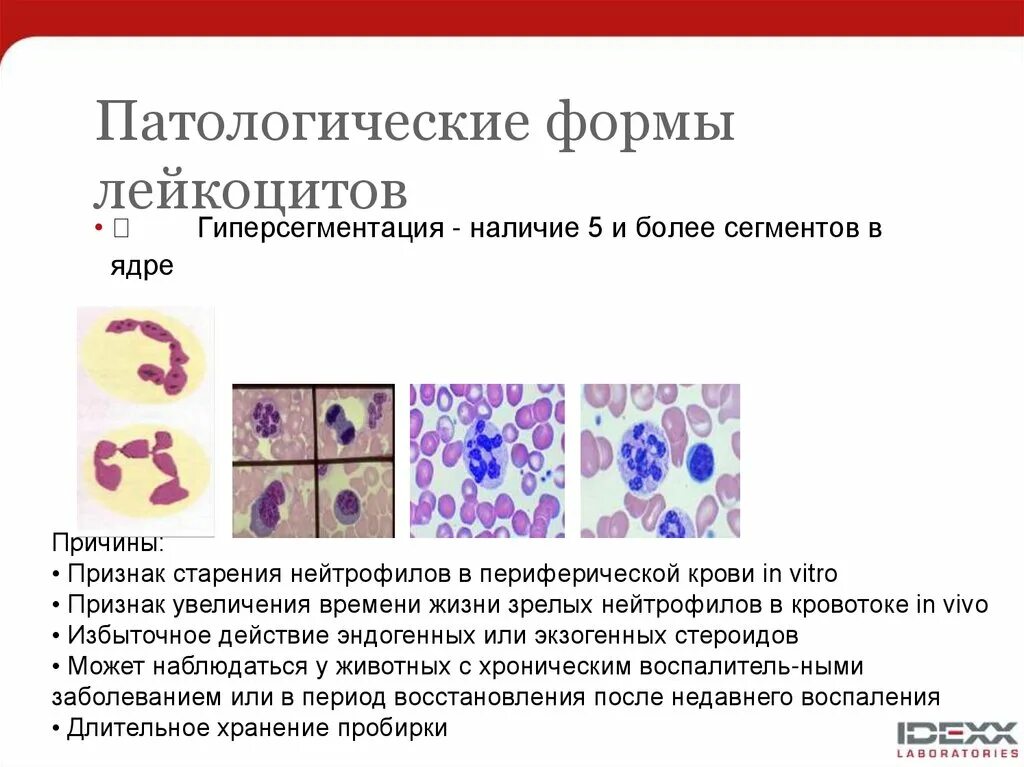 Лейкоциты строение и функции. Лейкоциты могут изменять форму. Лейкоцитарная формула лейкоцитарная формула. Патологические дегенеративные формы лейкоцитов. Показатели лейкоцитарной формулы крови.