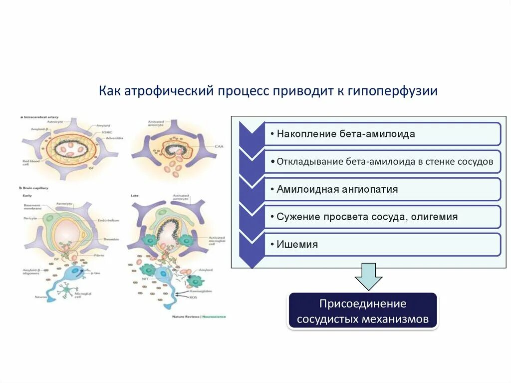 Причины атрофический процесс. Последствия атрофических процессов. Первичные атрофические процессы. Атрофический процесс жить.