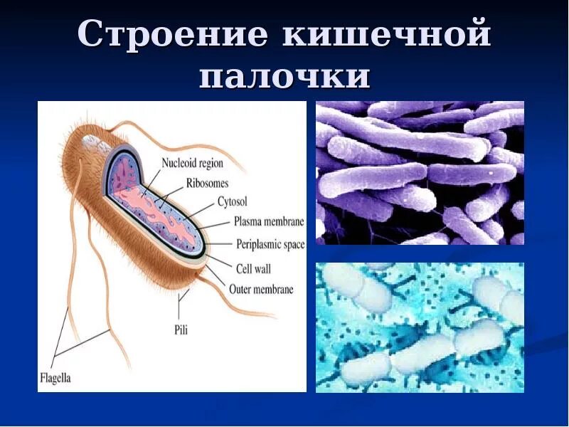 Escherichia coli строение. Кишечная палочка строение клетки. Бактерия кишечная палочка строение. Для кишечной палочки e. coli строение. В клетках бактерий есть ядро