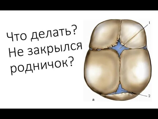 Закрытые роднички. Сроки закрытия родничков. Родничок у новорожденных щенков.