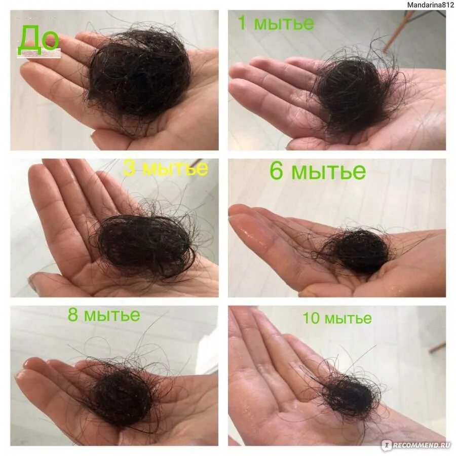 Сколько в норме выпадает