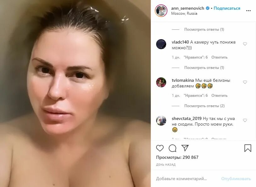 Анна астр слитые фото "Пыталась просто встать и не упасть". Анна Седокова впервые за долгое время посл