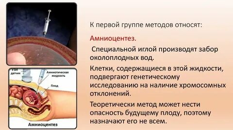 Кто делал амниоцентез форум