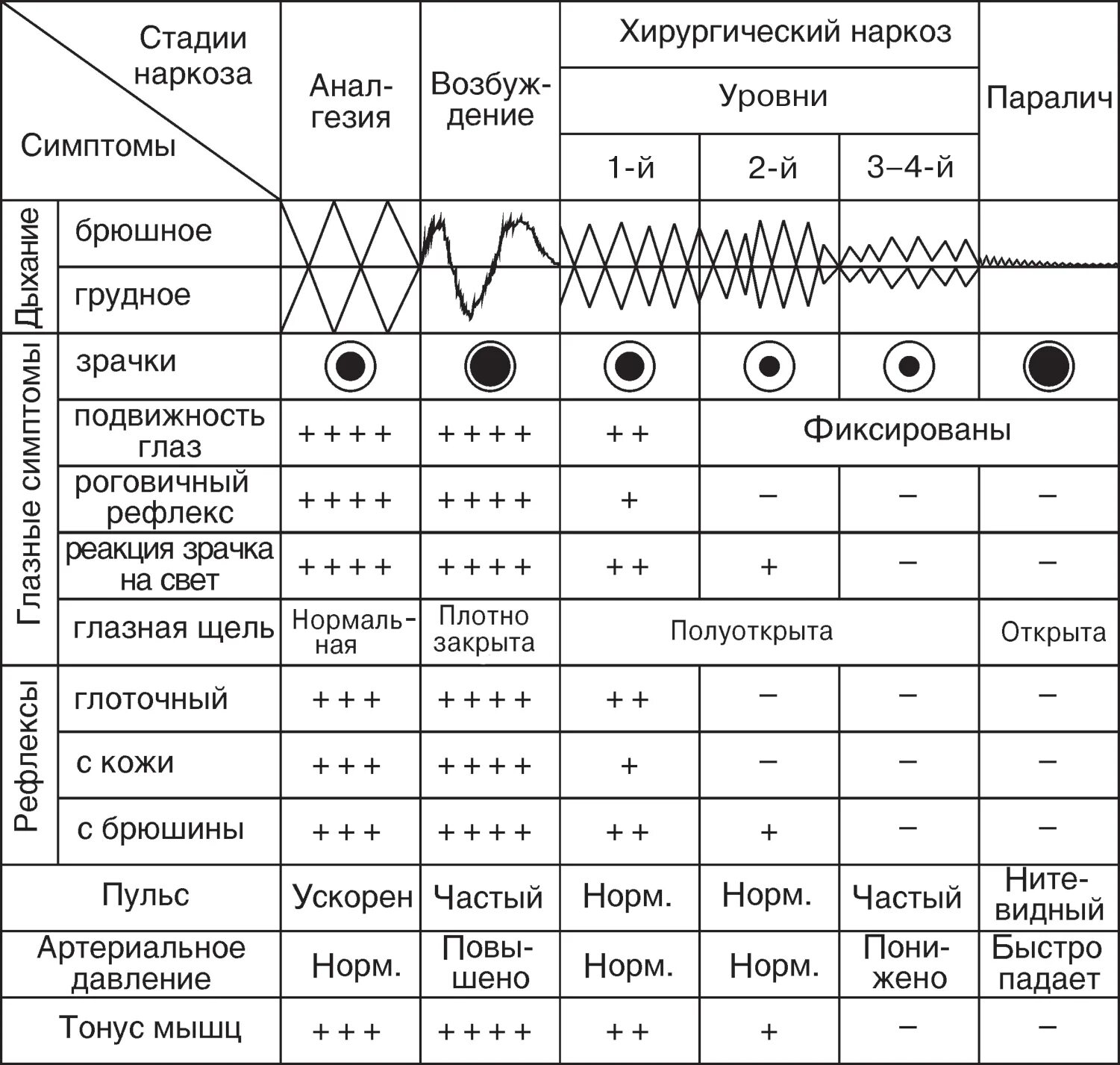 Схема стадий наркоза. Клиническая характеристика эфирно-кислородного наркоза.. Хирургические стадии наркоза таблица. Стадии эфирного наркоза, их клиническая характеристика.. Стадии анестезии