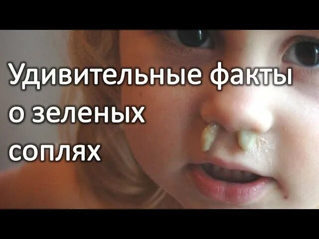 Какие зеленые сопли. Зелёные густые сопли у ребёнка. Зеленые тягучие сопли у ребенка. Желтые зеленые сопли Комаровский.