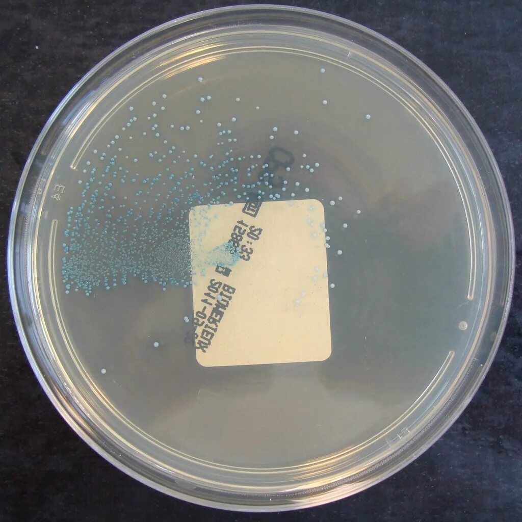 Enterococcus faecalis