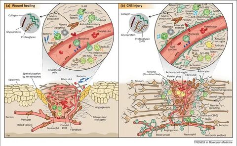 Wound healing