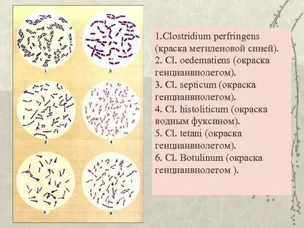 Клостридия перфрингенс