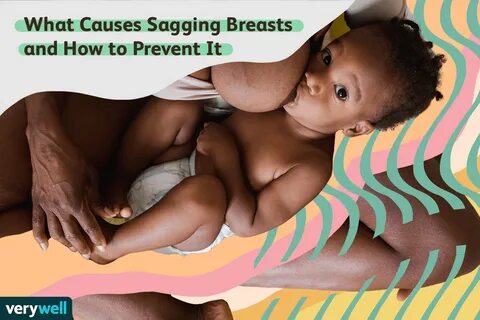 Common Causes of Sagging Breasts and Tips for Prevention.
