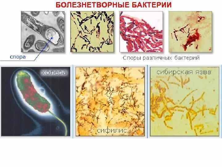 Болезнетворная бактерия 7. Строение болезнетворных бактерий. Сообщение о болезнетворных бактериях. Болезнетворные бактерии доклад. Болезнетворные бактерии и их названия.