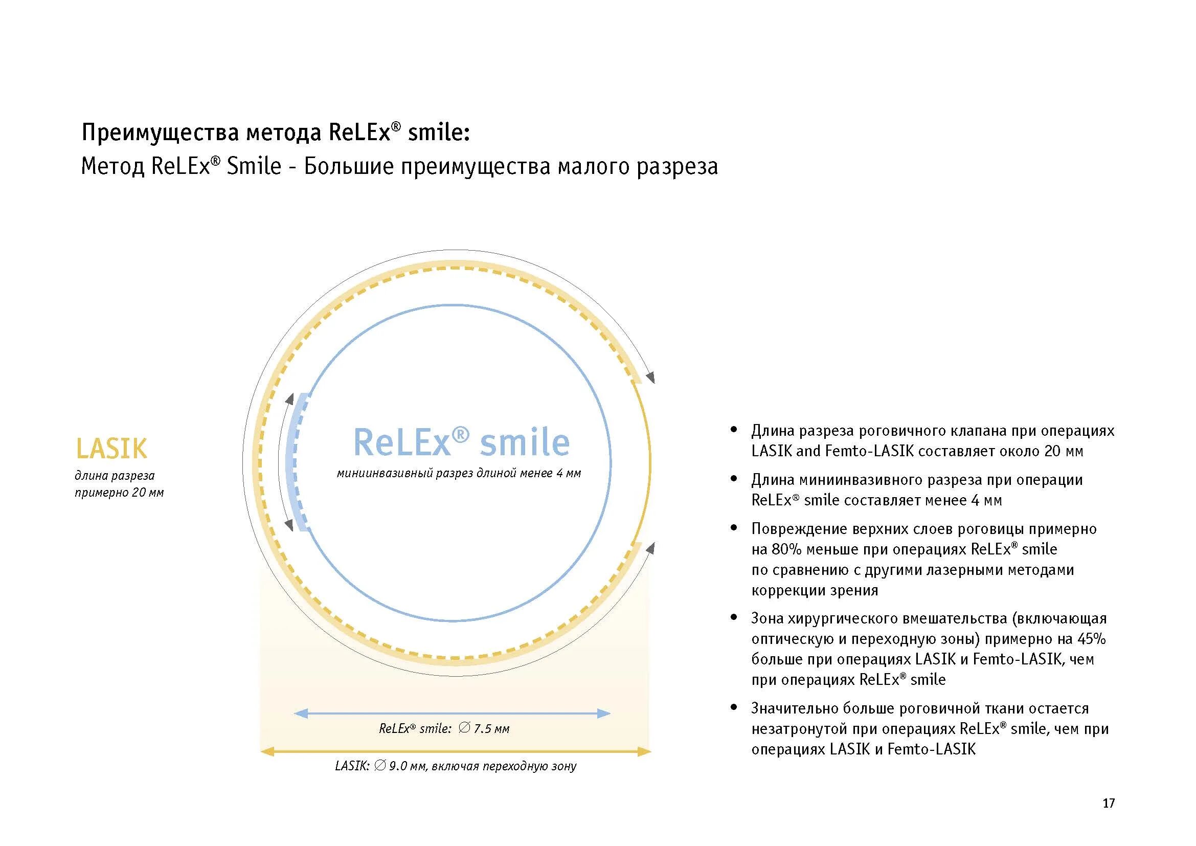 Коррекция smile clinicaspectr ru. RELEX smile лазерная коррекция зрения. Технология smile коррекция зрения. Метод RELEX smile. Лазерная коррекция методом smile.