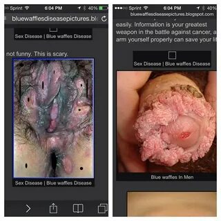 @uncle_ruckus_no_rel8tion this is the blue waffle male and. 