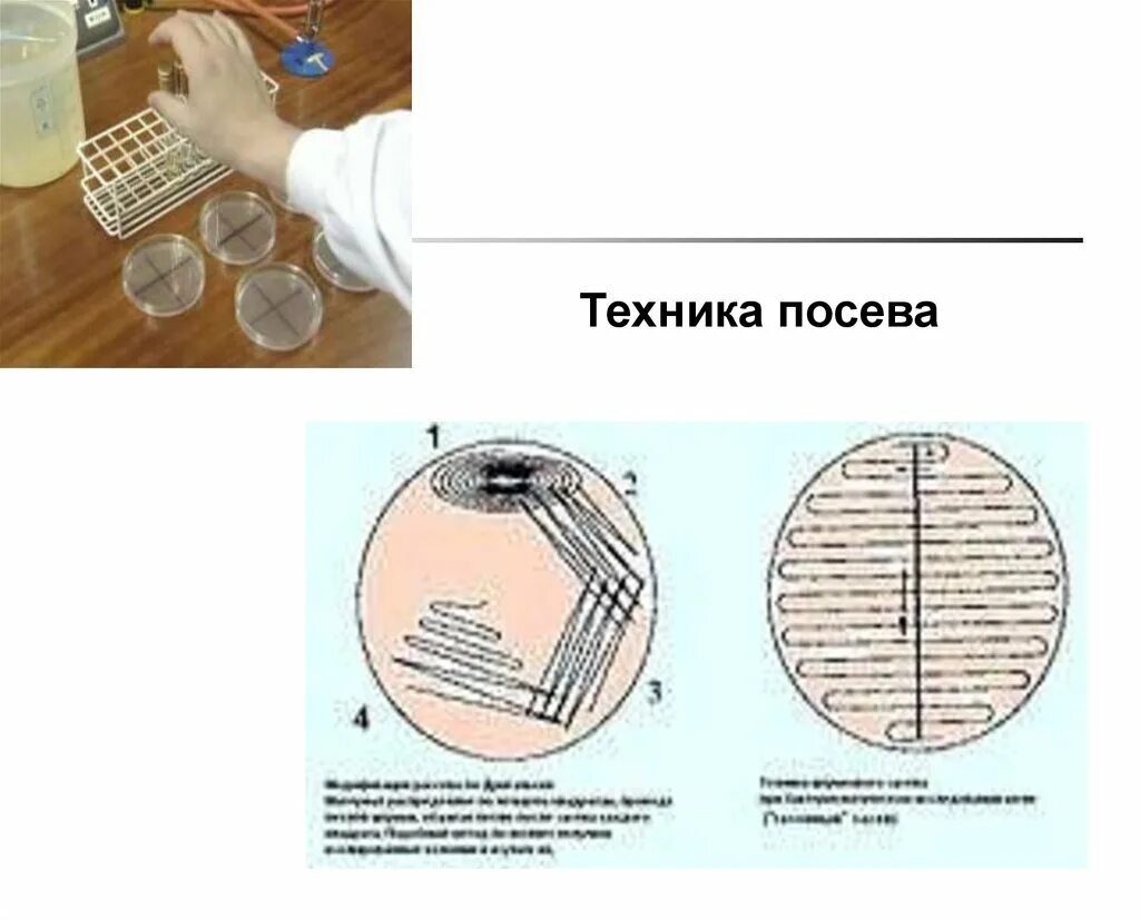 Методы посева микроорганизмов на питательные среды. Методы выделения чистой культуры бактерий. Техника микроорганизмов. Окраска по граму грамотрицательных бактерий. Оборудование для посева микроорганизмов.
