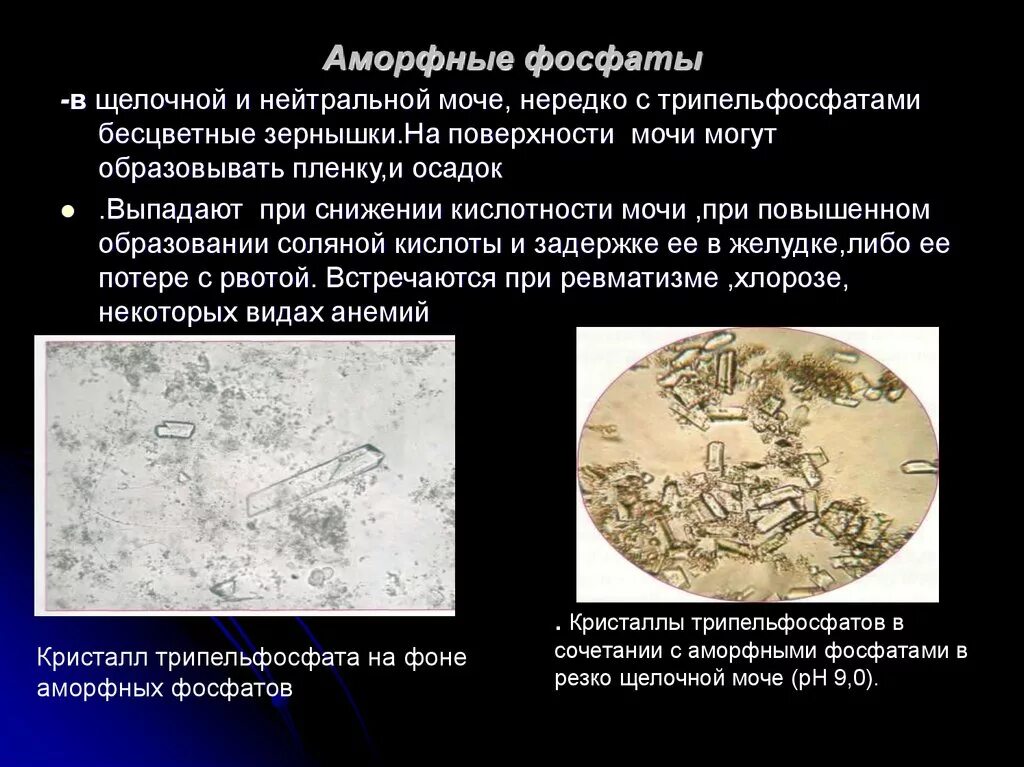 Фосфаты в какой моче. Фосфаты в моче. Амфотерные фосфаты в моче. Фосфаты и трипельфосфаты в моче. Фосфаты в моче осадок.