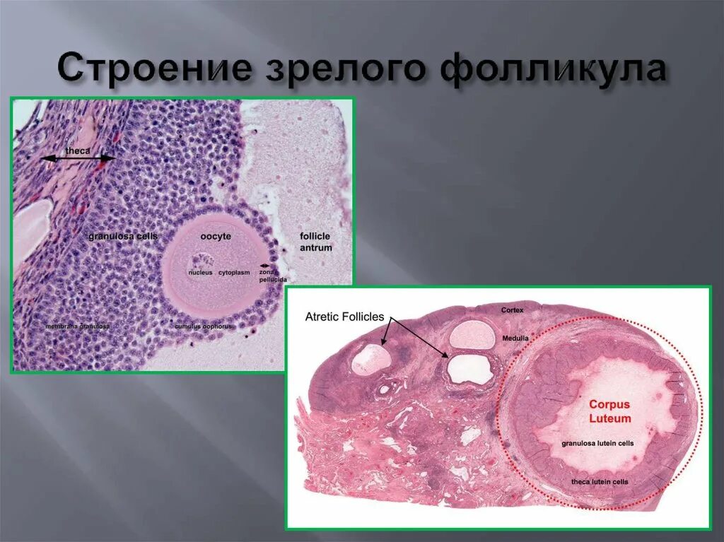 Граафов пузырек строение гистология. Строение фолликула гистология. Строение зрелого фолликула. Структура зрелого фолликула. 17 фолликулам