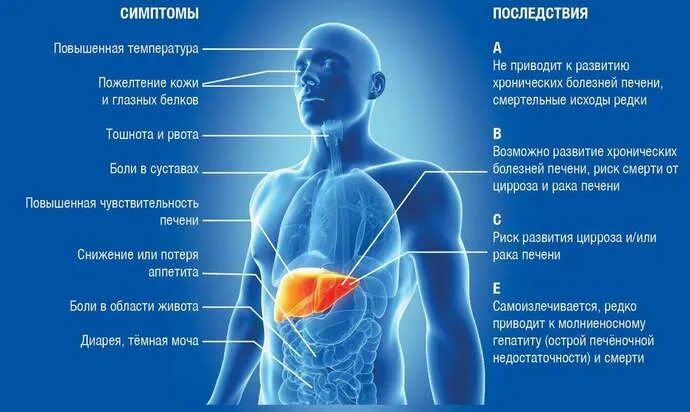 Больная печень и температура. Повышение температуры при гепатите. Живот болит при гепатите.