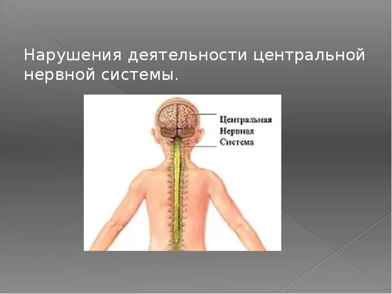 Нарушение центральной. Нарушение деятельности нервной системы. нарушения деятельности центральной нервной. центральная нервная система. нарушение работы цнс кратко.