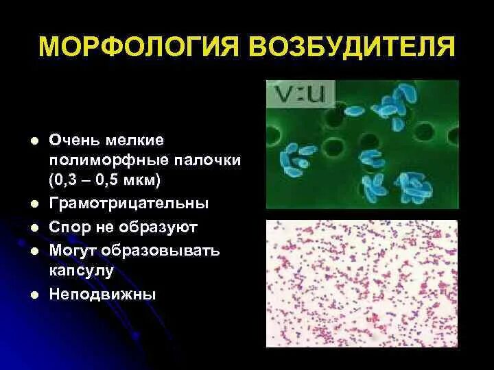 Бациллы морфологические и тинкториальные свойства. Мелкая и полиморфная палочка. Полиморфные бактерии. Грамм положительные палочки морфология. Полиморфные палочки что это такое.