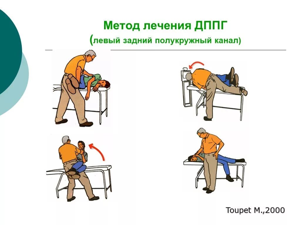 Доброкачественное головокружение упражнения. Доброкачественное позиционное головокружение упражнения. дппг заднего полукружного канала. гимнастика при доброкачественном позиционном головокружении. доброкачественное пароксизмальное позиционное головокружение.
