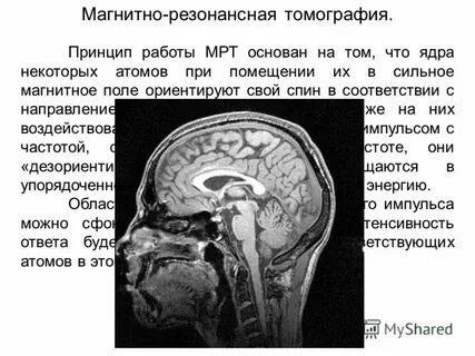 Что такое мрт и для чего его