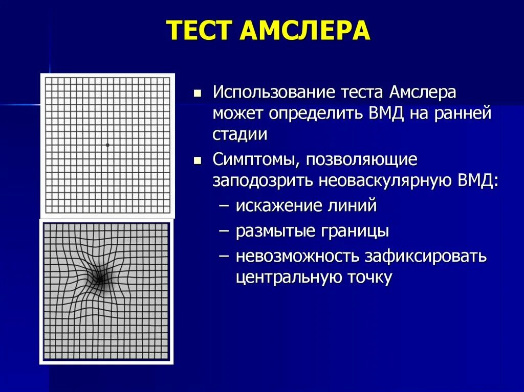 Тест сетчатки глаза