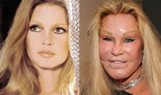 Ответы Mail.ru: jocelyn wildenstein-жертва пластической хирургии.. жесть правда?