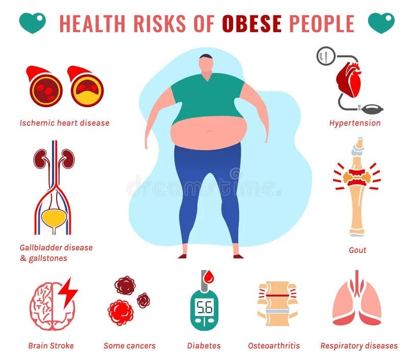 Classification of obesity. Лишний вес инфографика. Consequences of obesity. Obesity diseases. Чайлдхуд.