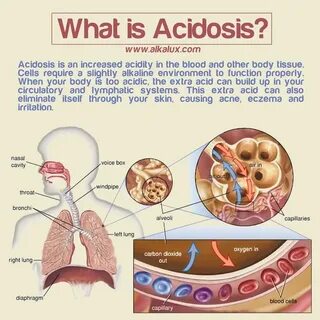 Acidosis тэ