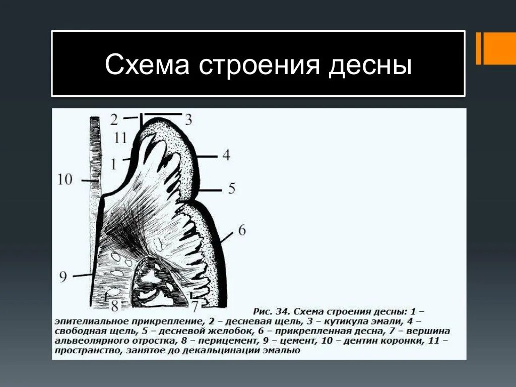 Строение десны анатомия. Схема гистологического строения десны.