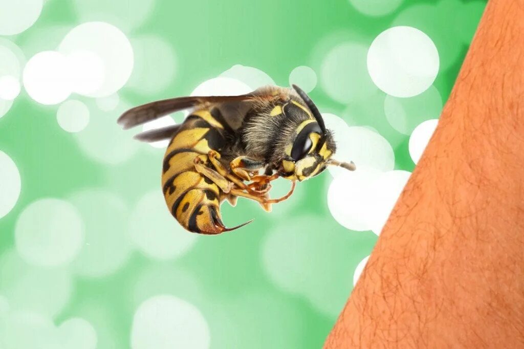 Being stung by a bee. Bee sting. пчела работница. пчелиный яд.