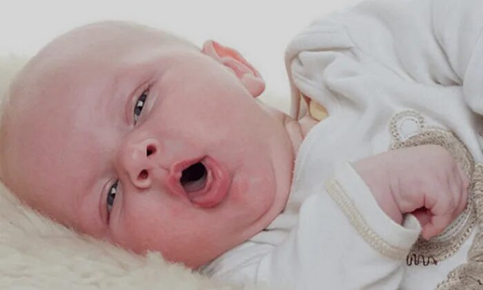 Врожденный стридор у новорожденных. Новорожденный стридор во сне. Врожденный стридор фото. Стридор у новорожденных фото.